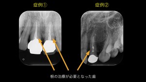 ブログ用症例取り出し.001